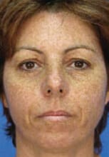 1764729246_Layer-89-1