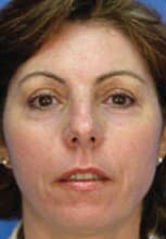 1764729253_Layer-90-1