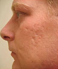 1764729299_Layer-92-1 Profractional