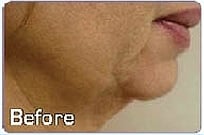 1764729341_Layer-65 Face & Body Sculpting