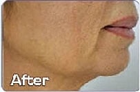 1764729348_Layer-66 Face & Body Sculpting