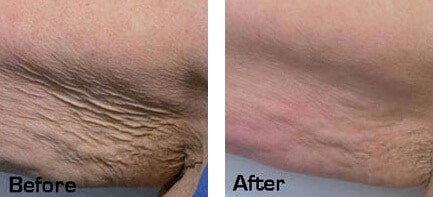 1764729354_Layer-76 Face & Body Sculpting