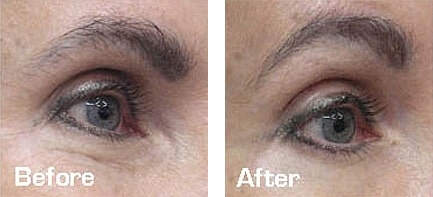 1764729361_Layer-74-1 Face & Body Sculpting