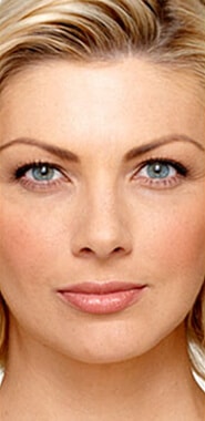 1764729382_Layer-59 Botox