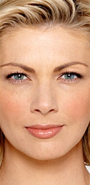 1764729389_Layer-60 Botox