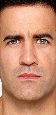 1764729397_Layer-62 Botox