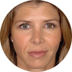 1764729511_Layer-77 Restylane