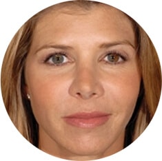 1764729517_Layer-78 Restylane