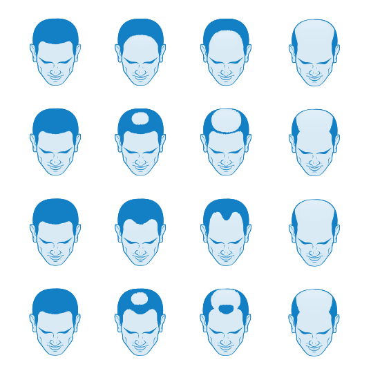 Men’s Hair Replacement